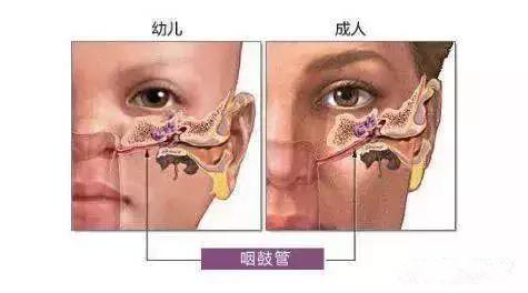 查疾病 疾病文章 > 詳細內容 雖然很多兒童中耳炎是由感冒,發燒